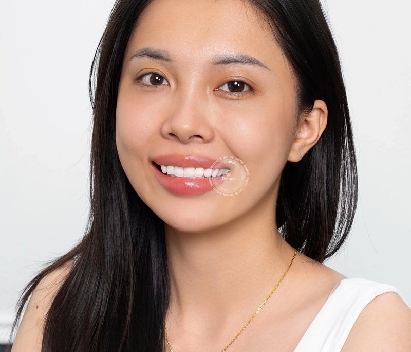 Hơn 30.000 khách hàng kiến tạo nụ cười thành công tại Dentos